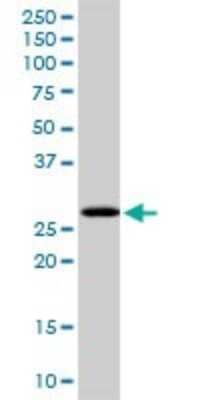 Western Blot: PCGF1 Antibody [H00084759-D01P]