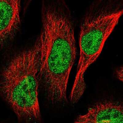 Immunocytochemistry/ Immunofluorescence: PCGF3 Antibody [NBP2-57696]