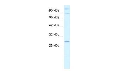 Western Blot: PCGF3 Antibody [NBP2-88019]