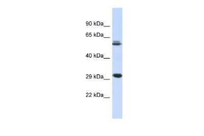 Western Blot: PCGF3 Antibody [NBP2-88020]