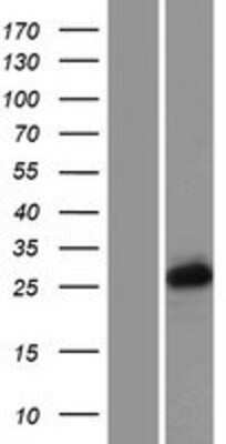 Western Blot: PCGF3 Overexpression Lysate [NBP2-07642]