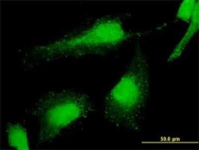 Immunocytochemistry/ Immunofluorescence: PCGF6 Antibody (2B8) [H00084108-M01]