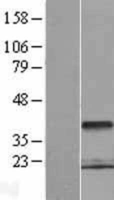 Western Blot: PCGF6 Overexpression Lysate [NBP2-06068]