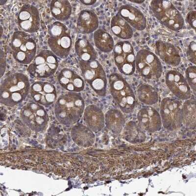 Immunohistochemistry-Paraffin: PCID2 Antibody [NBP2-49586]