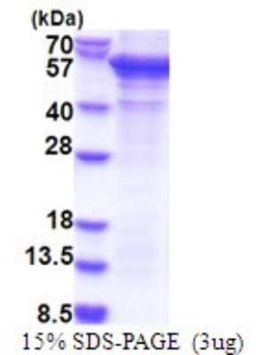 SDS-PAGE: Recombinant Human PCID2 His Protein [NBP2-51816]