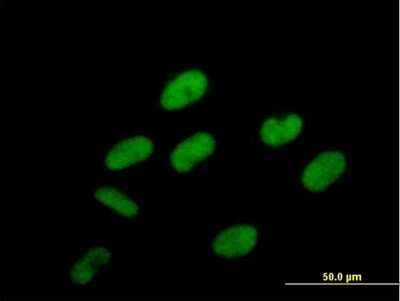 Immunocytochemistry/ Immunofluorescence: PCIF1 Antibody [H00063935-B01P]