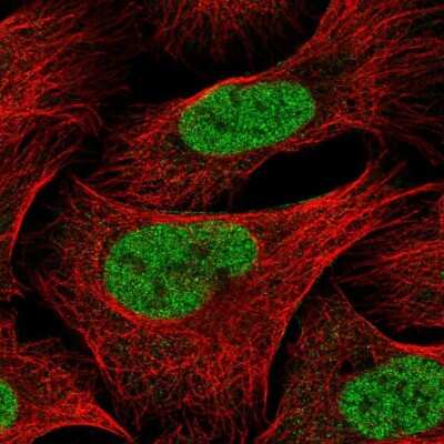 Immunocytochemistry/ Immunofluorescence: PCIF1 Antibody [NBP2-13740]