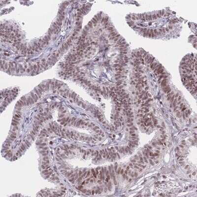 Immunohistochemistry-Paraffin: PCIF1 Antibody [NBP2-13740]