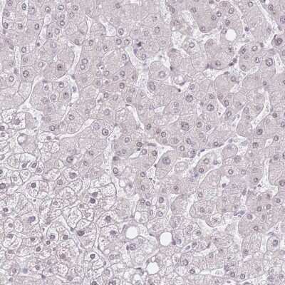 Immunohistochemistry-Paraffin: PCIF1 Antibody [NBP2-13740]