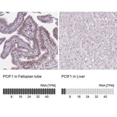 Immunohistochemistry-Paraffin: PCIF1 Antibody [NBP2-13740]