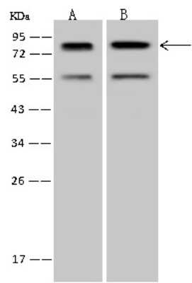 Western Blot: PCIF1 Antibody [NBP2-97683]