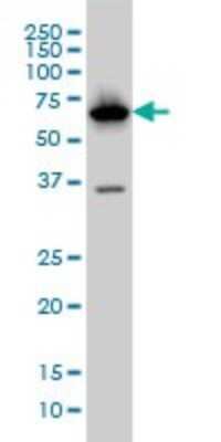 Western Blot: PCK1 Antibody (3E4) [H00005105-M01]