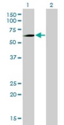 Western Blot: PCK1 Antibody (3E4) [H00005105-M01]