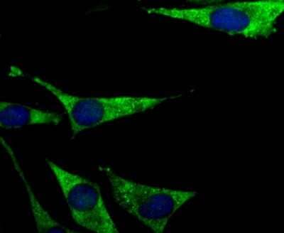 Immunocytochemistry/ Immunofluorescence: PCK1 Antibody (JU84-39) [NBP2-75609]