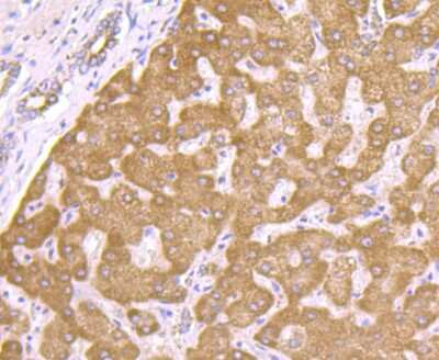 Immunohistochemistry-Paraffin: PCK1 Antibody (JU84-39) [NBP2-75609]
