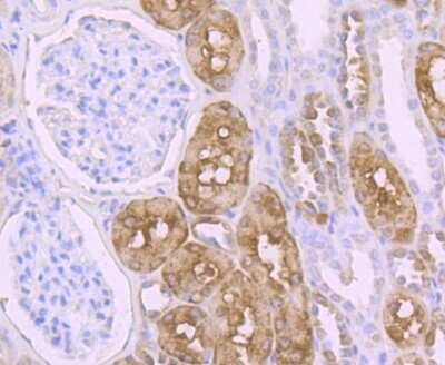Immunohistochemistry-Paraffin: PCK1 Antibody (JU84-39) [NBP2-75609]