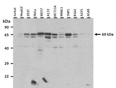 Western Blot: PCK1 Antibody [NBP1-54720]