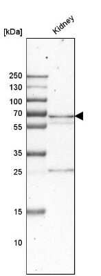 Western Blot: PCK1 Antibody [NBP1-80927]