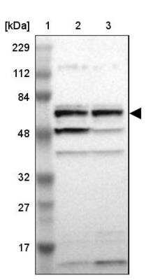 Western Blot: PCK1 Antibody [NBP1-80928]