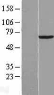 Western Blot: PCK1 Overexpression Lysate [NBL1-14179]