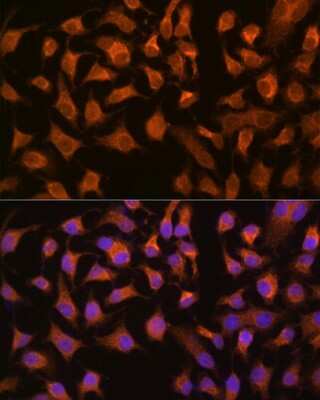 Immunocytochemistry/ Immunofluorescence: PCK2 Antibody (10L10J8) [NBP3-16418]