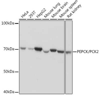 Western Blot: PCK2 Antibody (10L10J8) [NBP3-16418]