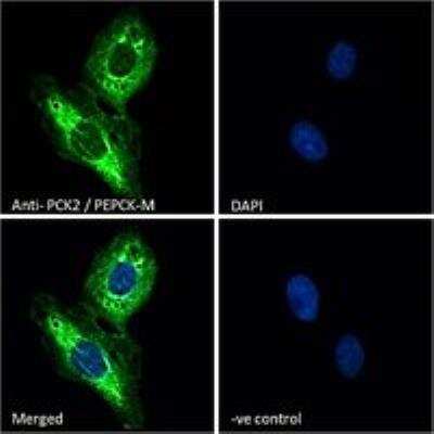 Immunocytochemistry/ Immunofluorescence: PCK2 Antibody [NB100-2422]