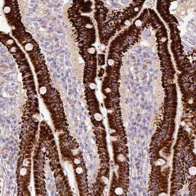 Immunohistochemistry: PCK2 Antibody [NBP2-33606]