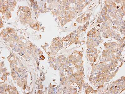 Immunohistochemistry-Paraffin: PCK2 Antibody [NBP1-31241]
