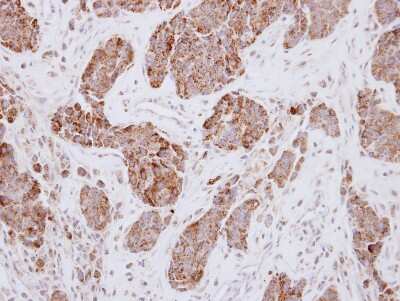 Immunohistochemistry-Paraffin: PCK2 Antibody [NBP2-19729]