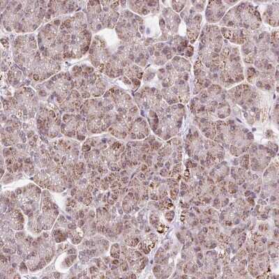 Immunohistochemistry-Paraffin: PCK2 Antibody [NBP2-33606]