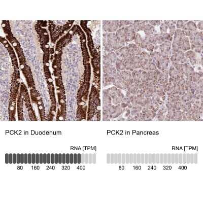 Immunohistochemistry-Paraffin: PCK2 Antibody [NBP2-33606]