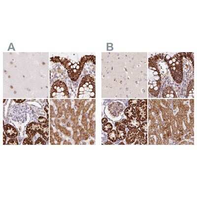 Immunohistochemistry-Paraffin: PCK2 Antibody [NBP2-33606]