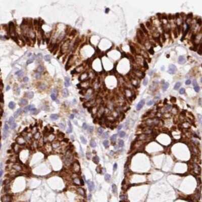Immunohistochemistry-Paraffin: PCK2 Antibody [NBP2-33606]