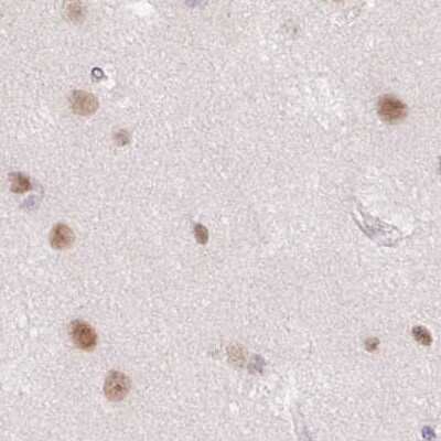 Immunohistochemistry-Paraffin: PCK2 Antibody [NBP2-33606]