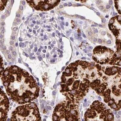 Immunohistochemistry-Paraffin: PCK2 Antibody [NBP2-33606]
