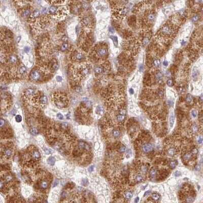 PCK2 Antibody (NBP233606) by Novus, Part of BioTechne