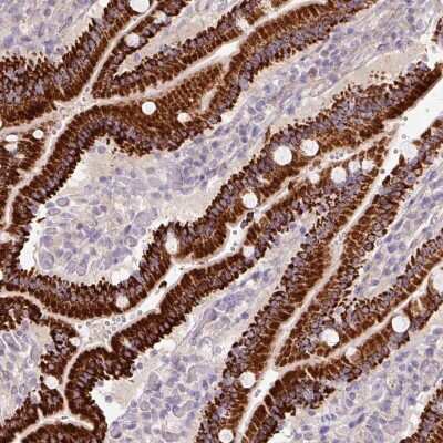 Immunohistochemistry-Paraffin: PCK2 Antibody [NBP2-33685]