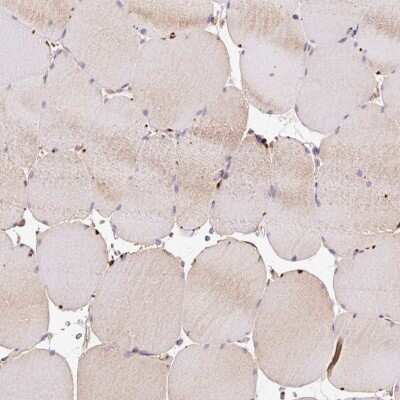 Immunohistochemistry-Paraffin: PCK2 Antibody [NBP2-33685]