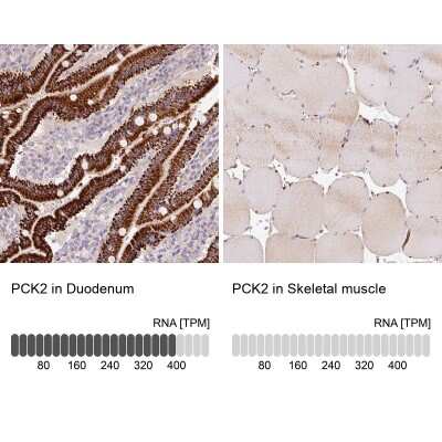 Immunohistochemistry-Paraffin: PCK2 Antibody [NBP2-33685]