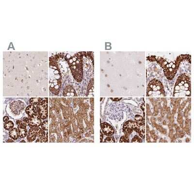Immunohistochemistry-Paraffin: PCK2 Antibody [NBP2-33685]