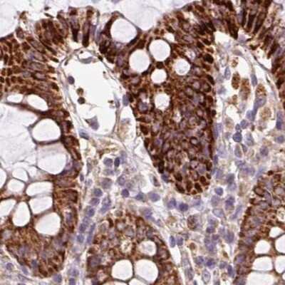 Immunohistochemistry-Paraffin: PCK2 Antibody [NBP2-33685]
