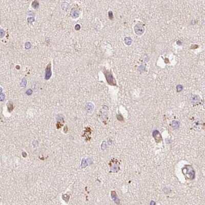 Immunohistochemistry-Paraffin: PCK2 Antibody [NBP2-33685]
