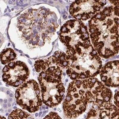 Immunohistochemistry-Paraffin: PCK2 Antibody [NBP2-33685]