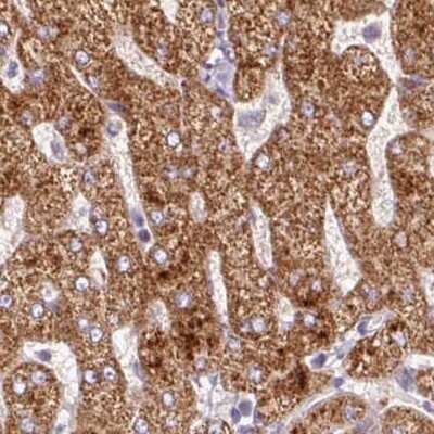 Immunohistochemistry-Paraffin: PCK2 Antibody [NBP2-33685]