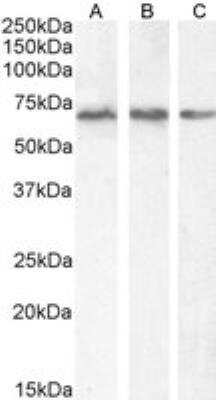 Western Blot: PCK2 Antibody [NB100-2422]