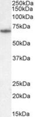 Western Blot: PCK2 Antibody [NB100-2422]