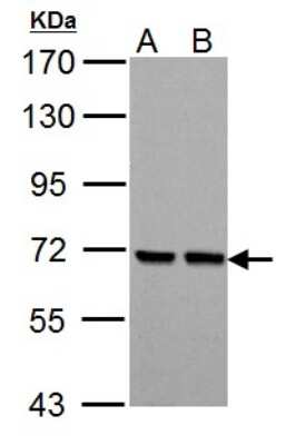 Western Blot: PCK2 Antibody [NBP1-31241]