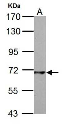 Western Blot: PCK2 Antibody [NBP1-31241]