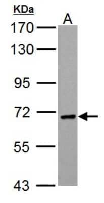 Western Blot: PCK2 Antibody [NBP1-31241]